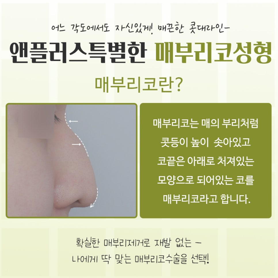 If You’re Looking for Reviews of Hump Nose Surgery image 3