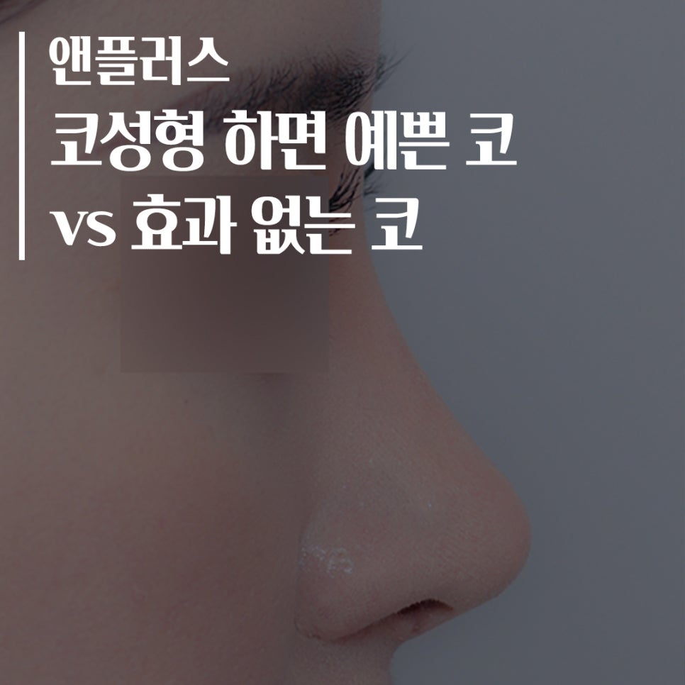 코성형 하면 예쁜코와 효과 없는 코! 관련 이미지 1