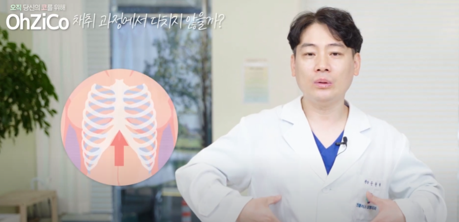 A Complete Guide to Autologous Rib Cartilage Used in Rhinoplasty! image 16