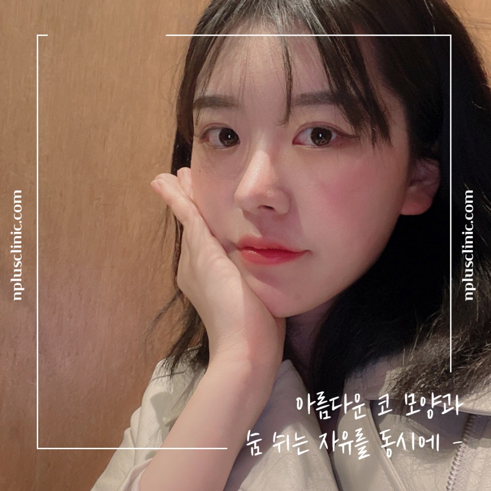 코수술전후 확실한 변화로 관련 이미지 9