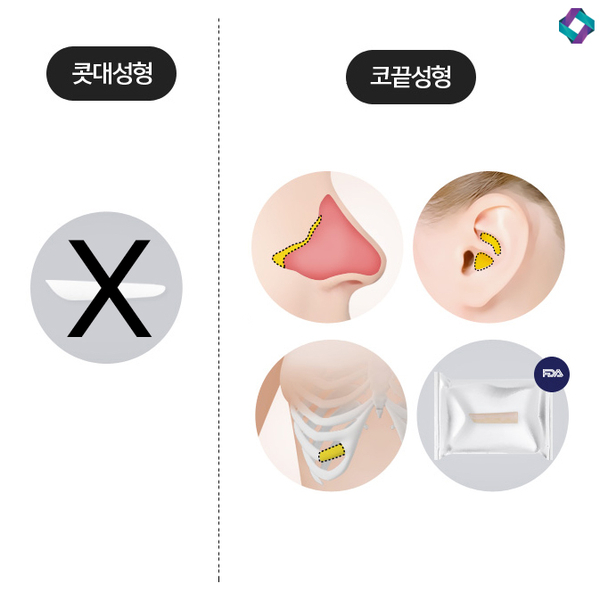 What to Know When Having Surgery Without an Implant Using Nasal Cartilage image 5