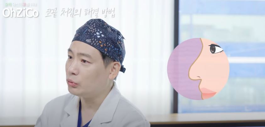 코성형 후 코끝처짐 원인과 해결 방법 관련 이미지 16