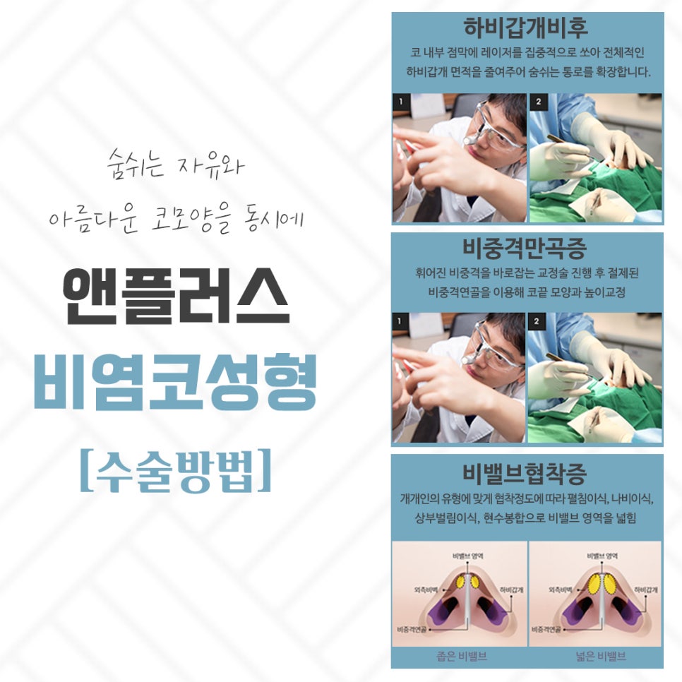 If You Are Checking Reviews of Rhinitis Nose Surgery image 7