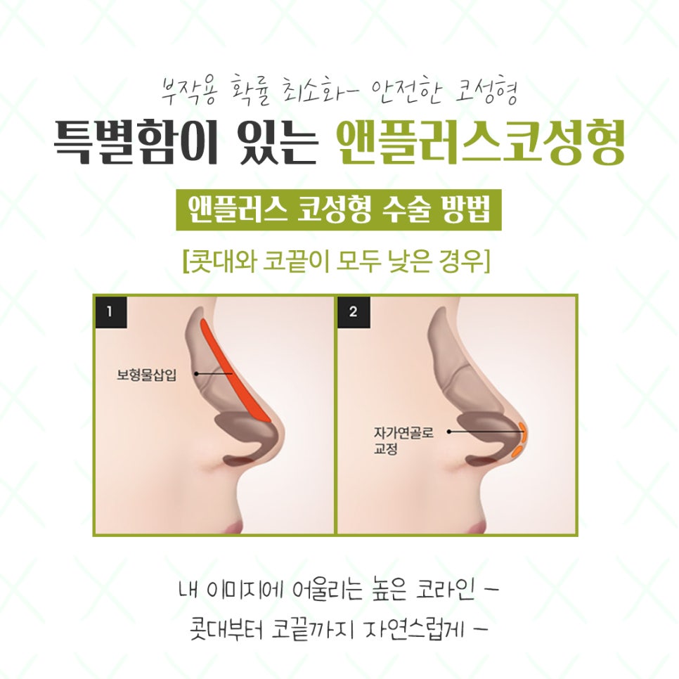 코성형전후를 찾아본다면 관련 이미지 8