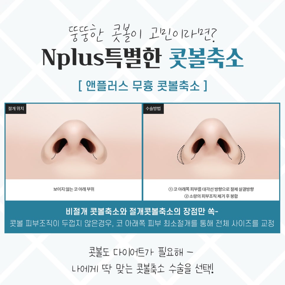 Choosing After Checking Rhinoplasty Alar Reduction Surgery Reviews image 7