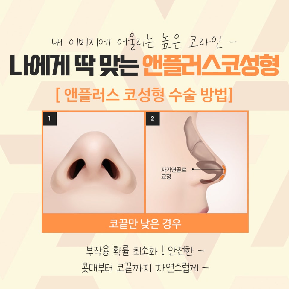 자가연골코수술을 통한 이미지 개선 관련 이미지 10