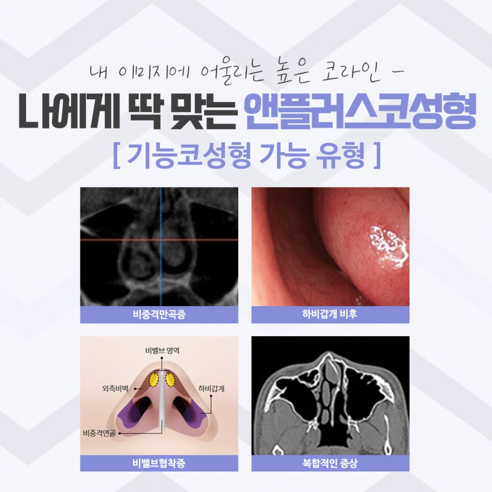 코성형후기 이미지를 예쁘고 자연스럽게 관련 이미지 6