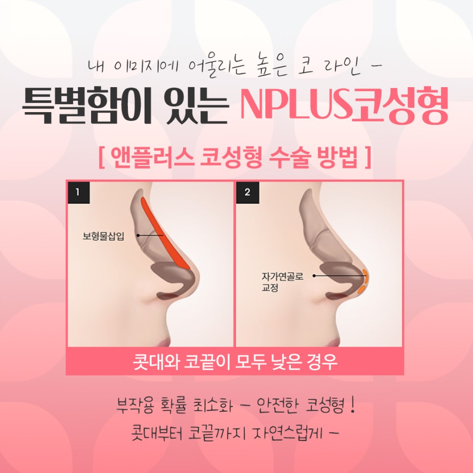 If You’re Looking for Detailed Reviews of Female Rhinoplasty image 8