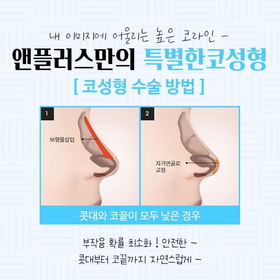 Learn About Autologous Cartilage Rhinoplasty image 7