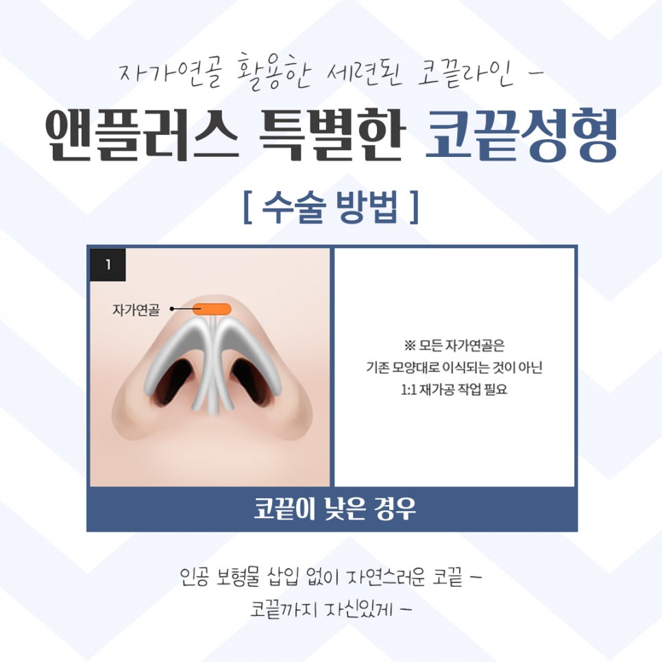 코끝성형 후기까지 확인하고 관련 이미지 8