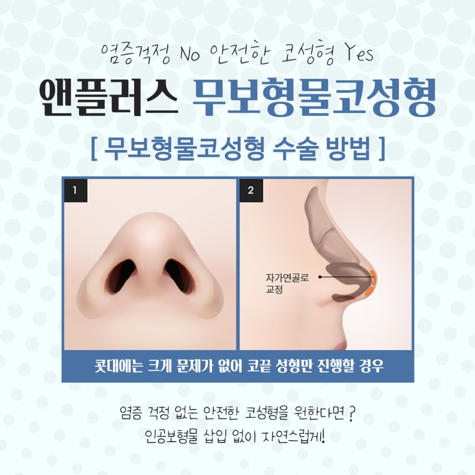무보형물코수술을 통해 자연스러운 코라인으로 관련 이미지 8