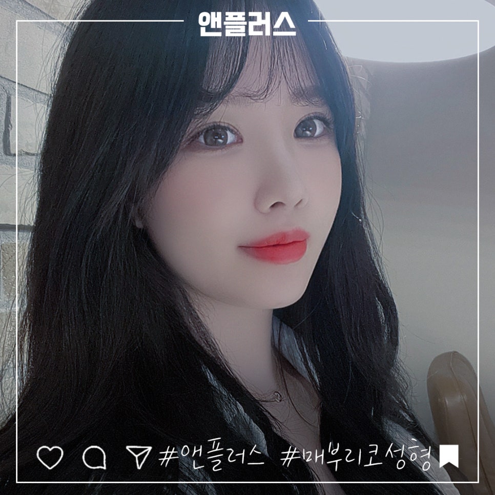 코끝처짐 개선한 매부리코성형후기 관련 이미지 1