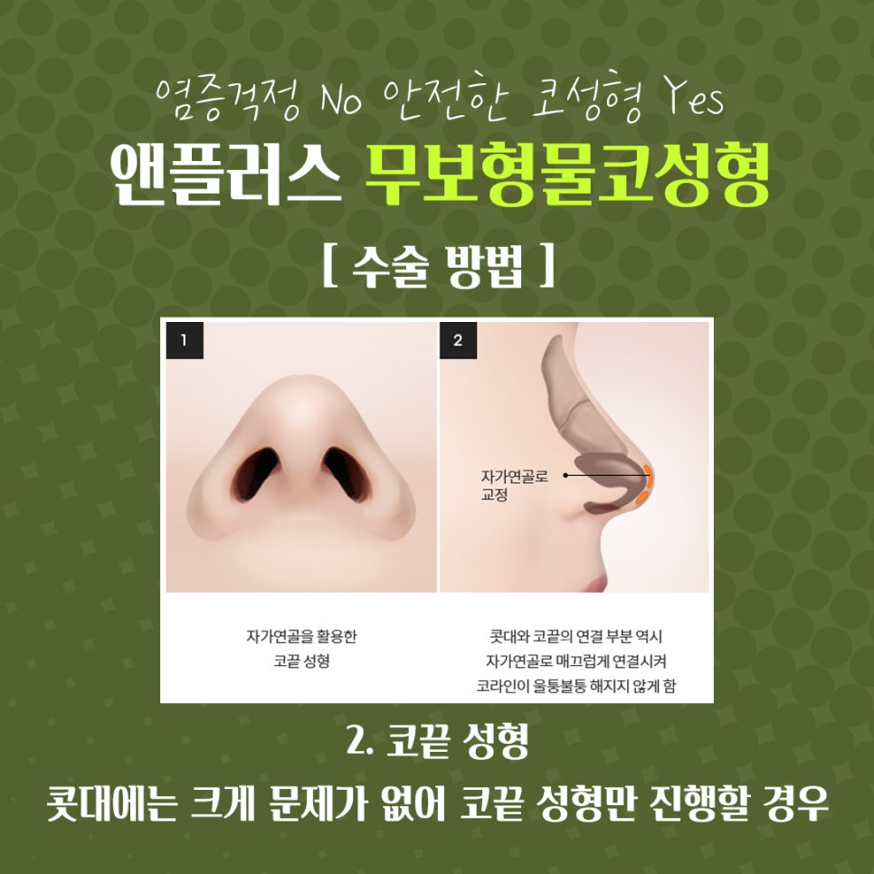 자가연골 활용한 코수술후기 관련 이미지 11