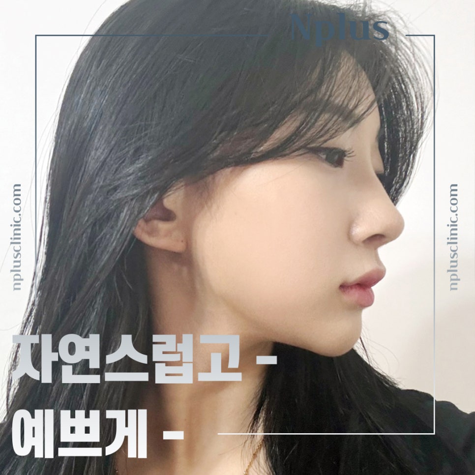 If You Are Looking in Detail at Functional Nose Surgery Before and After image 1