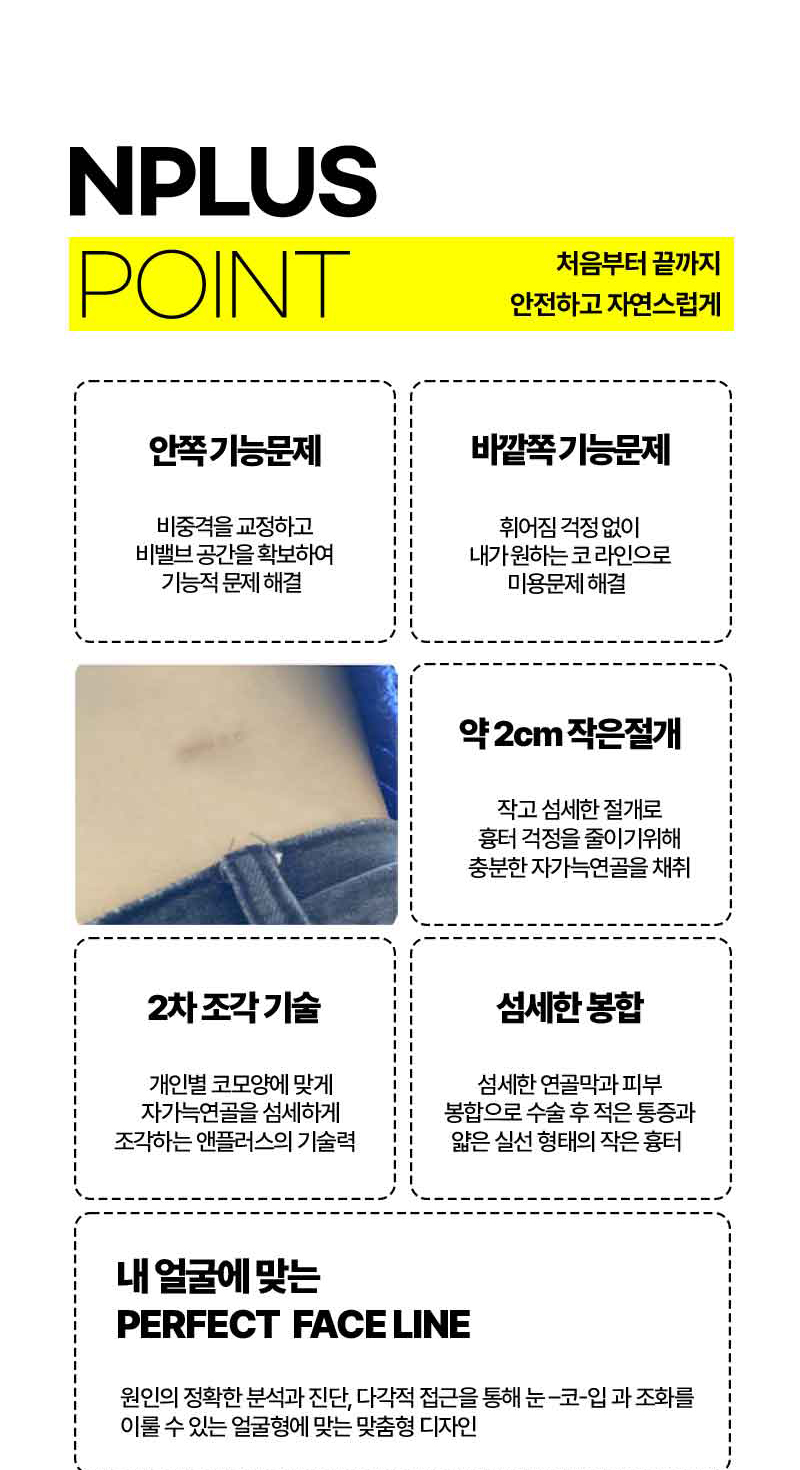앤플러스 자가늑코성형은 예쁘다! 관련 이미지 6