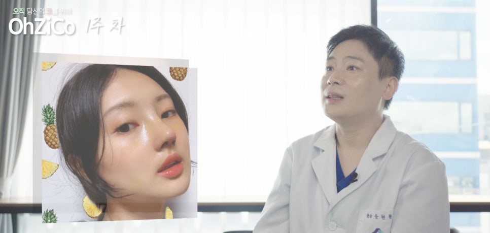 짧은코수술 후기까지 자세하게 알아보고 관련 이미지 23