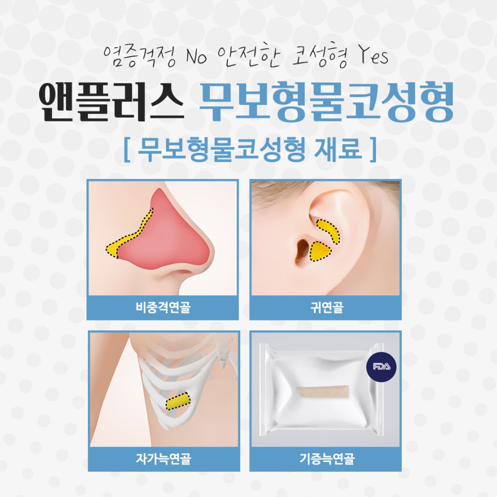 Non-Implant Rhinoplasty: Natural and Safe image 9
