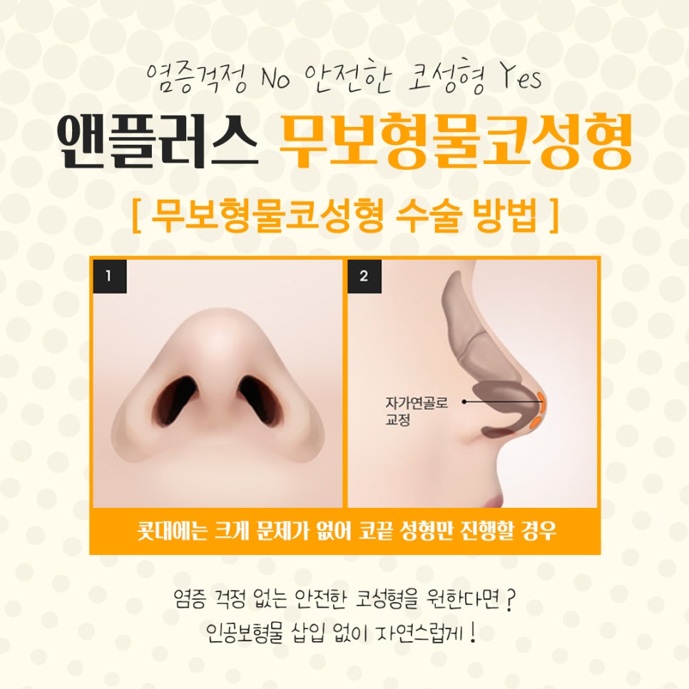 무보형물코수술에 대해 자세하게 알아보고 관련 이미지 8