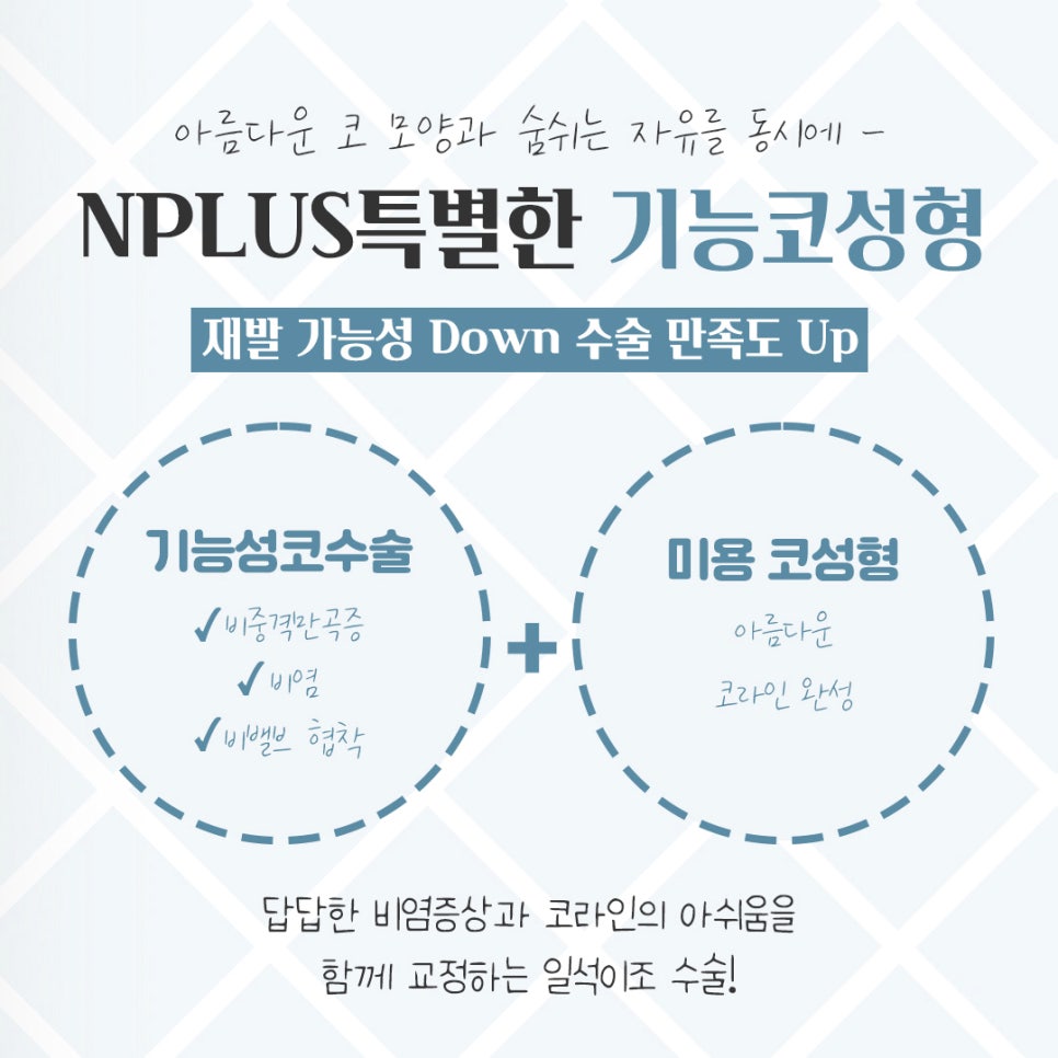 기능코성형후기를 통해 개선된 점 관련 이미지 3