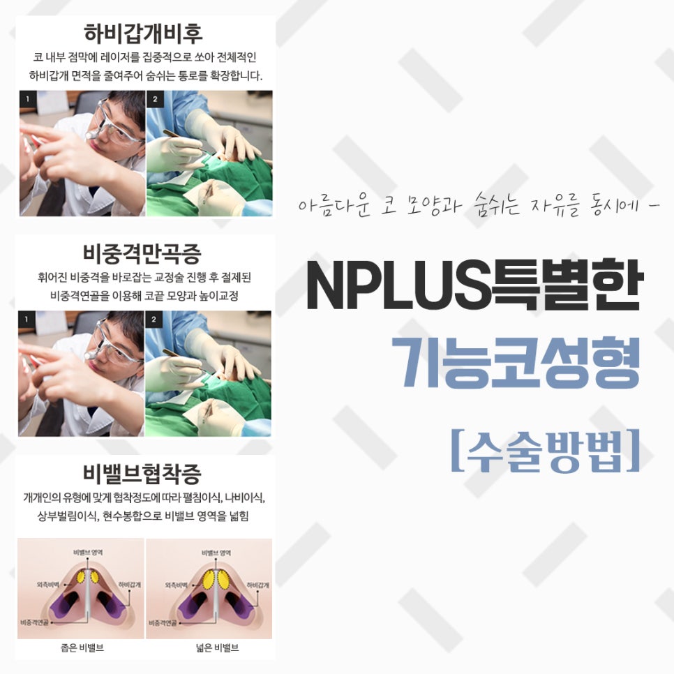 The Importance of Choosing Coverage for Nose Surgery image 9