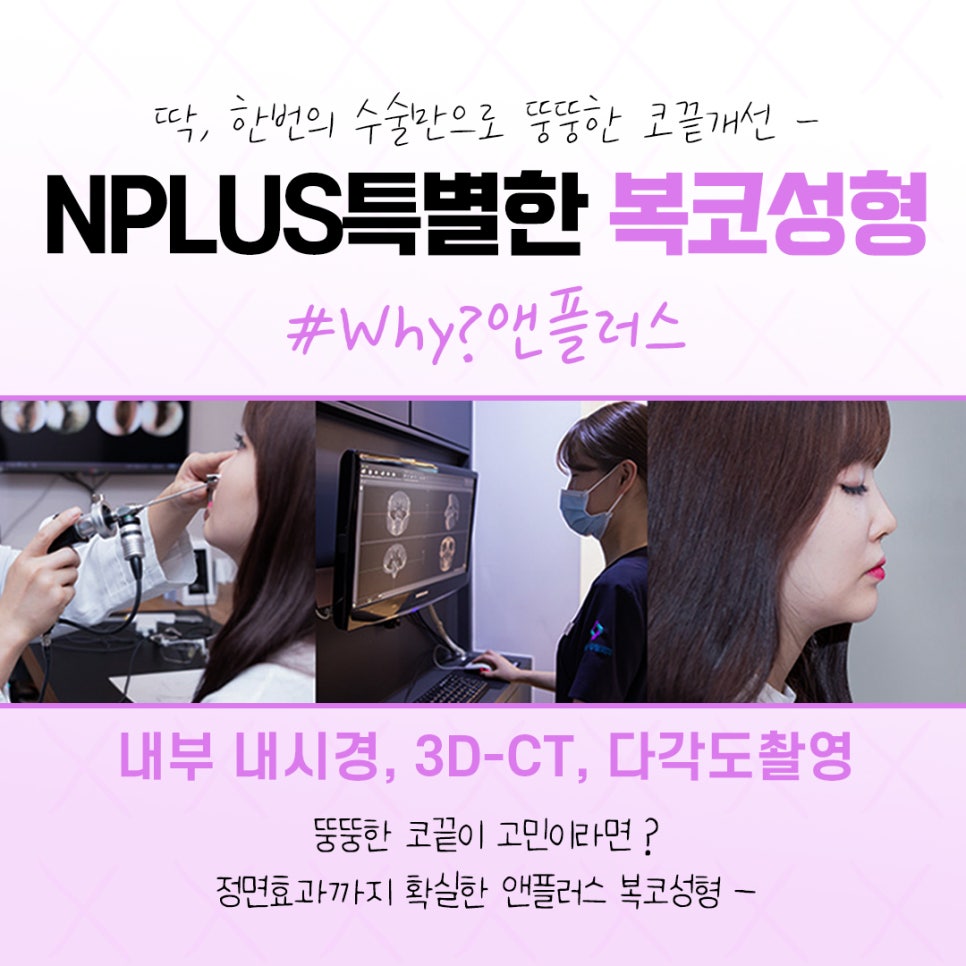 복코수술후기 날렵하고 세련된 라인으로 관련 이미지 6