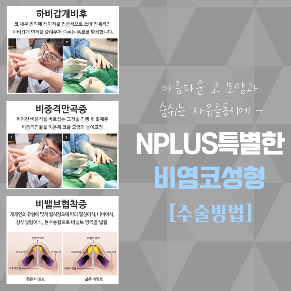The Importance of Choosing a Nasal Surgery Review image 9