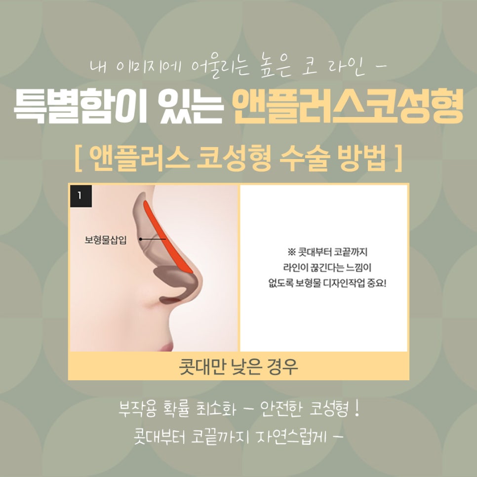 직반버선코 라인으로 교정된 코수술후기 관련 이미지 11