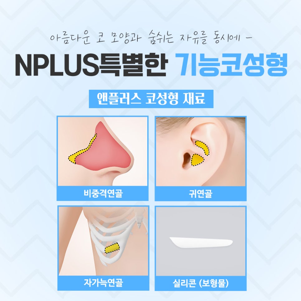 기능코성형후기를 신중하게 알아보고 관련 이미지 11