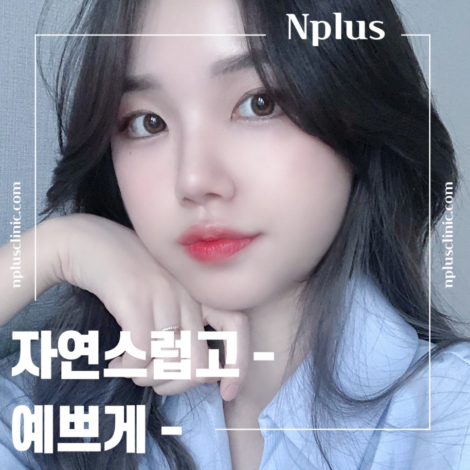 Rhinoplasty Review: Improved with a Refined Line image 7
