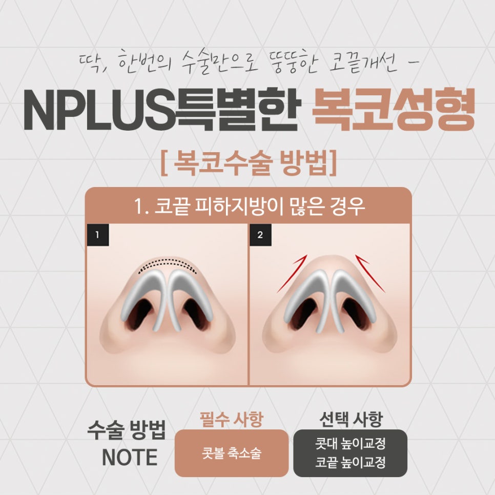 복코성형후기를 다양하게 찾아보고 관련 이미지 8