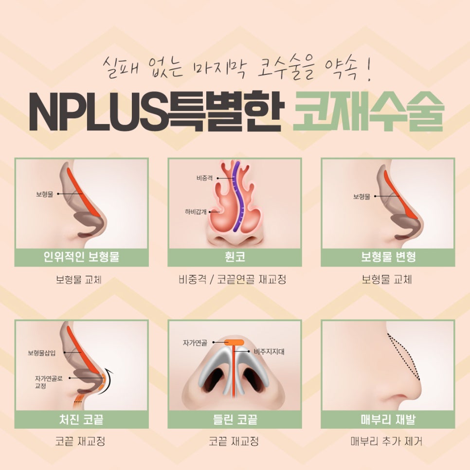 코재수술성형외과 잘 알아보고 결정해야 관련 이미지 8