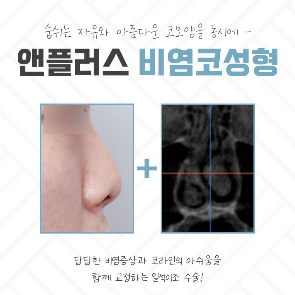 If You Are Checking Reviews of Rhinitis Nose Surgery image 3