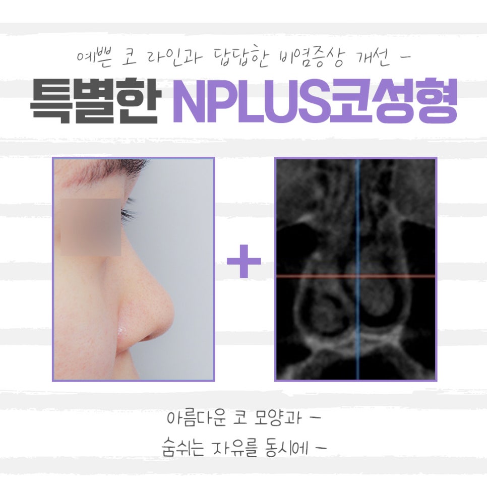Checking Whether Low Nose Surgery Reviews Are Safe image 4