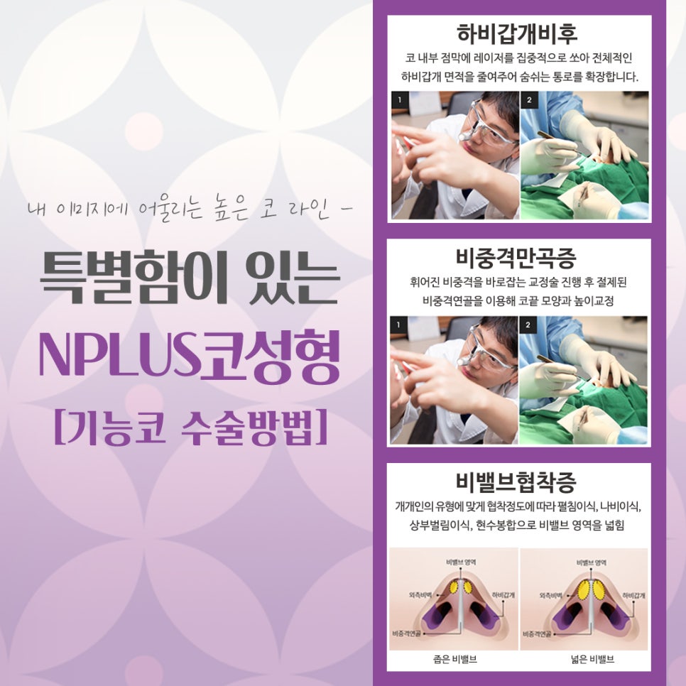 강남코수술에서 자연스럽고 예쁜 코라인! 관련 이미지 9
