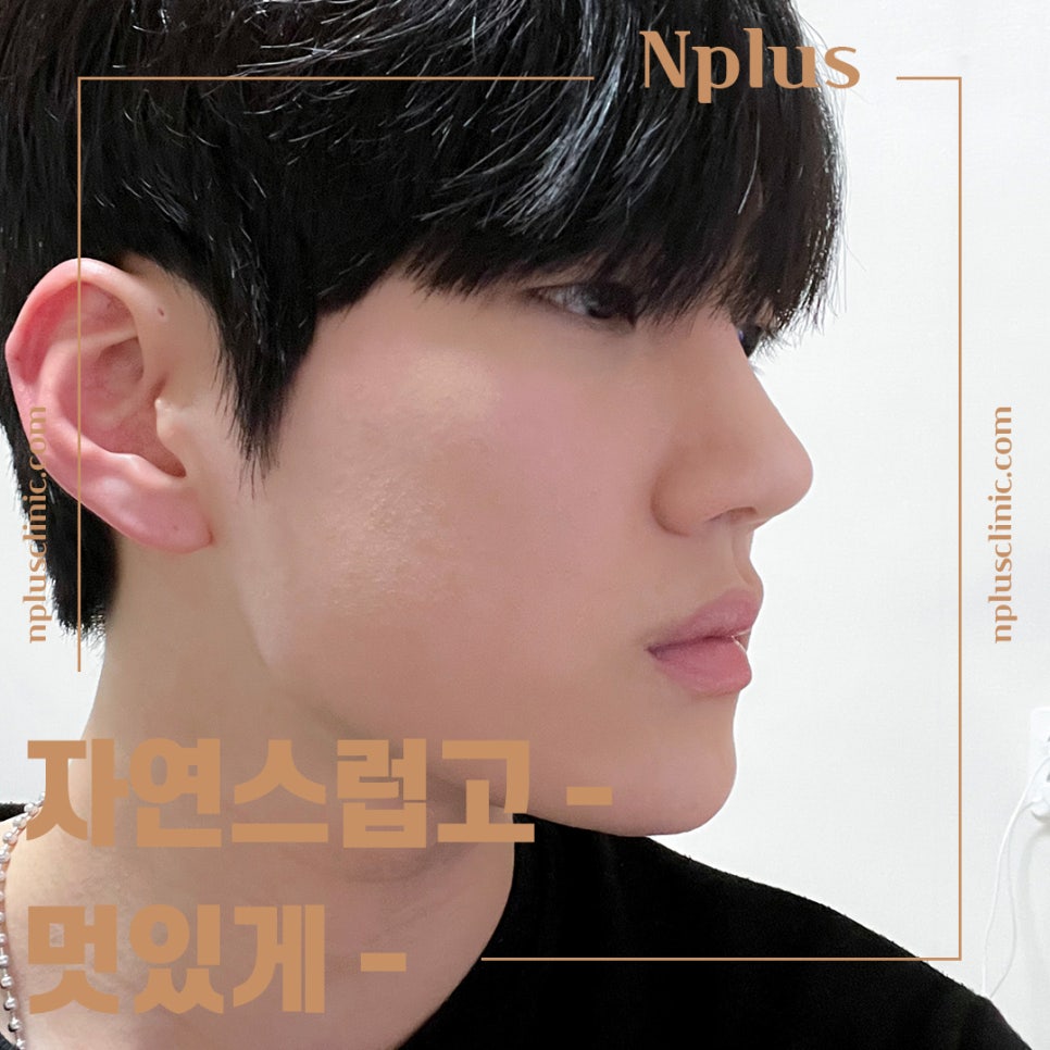 남자코성형전후 확인하고 개선 관련 이미지 13