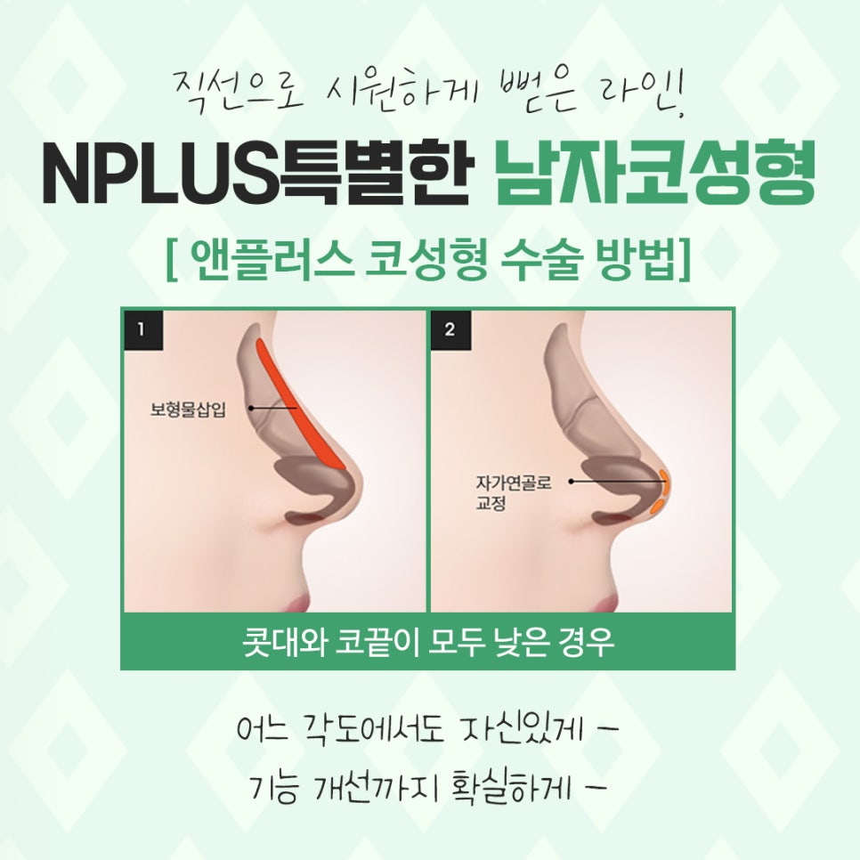 남자코수술후기 멋있고 자연스러운 라인으로 관련 이미지 9
