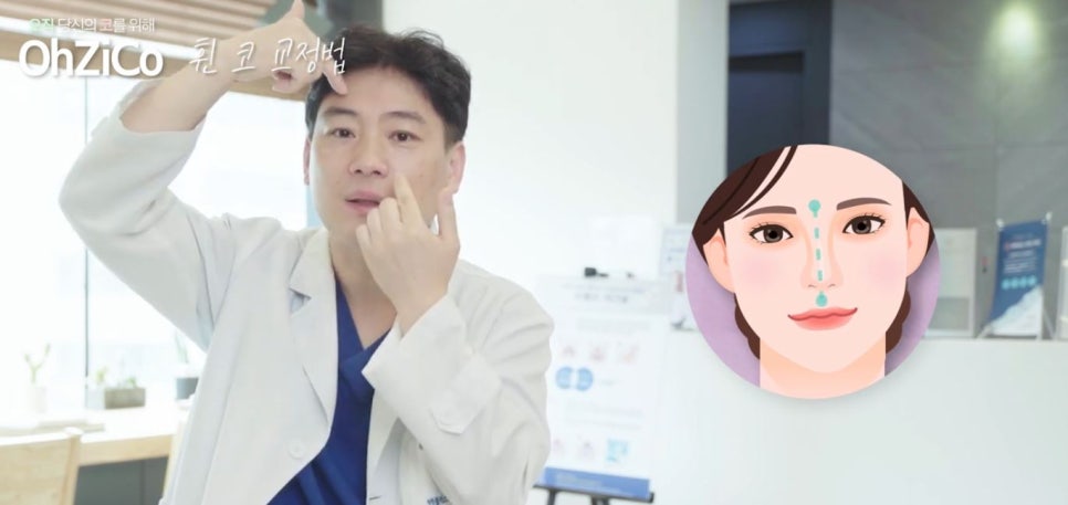 코성형 하면 예쁜코와 효과 없는 코! 관련 이미지 15