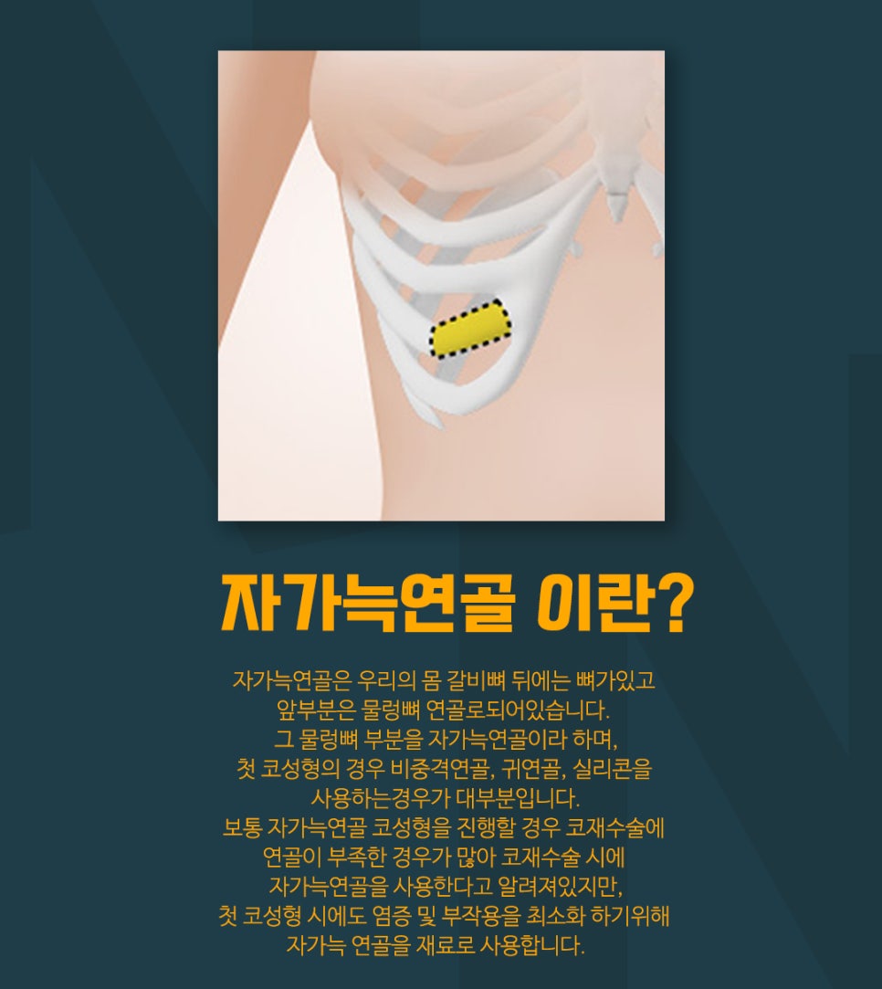 코성형,첫 수술부터 갈비뼈(자가늑연골)로 이식해야 하는 이유 관련 이미지 7