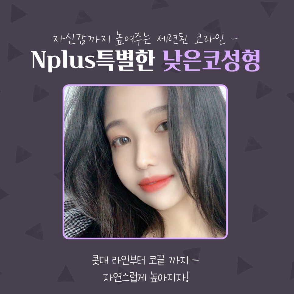 낮은코수술후기 세련된 코라인으로 관련 이미지 2