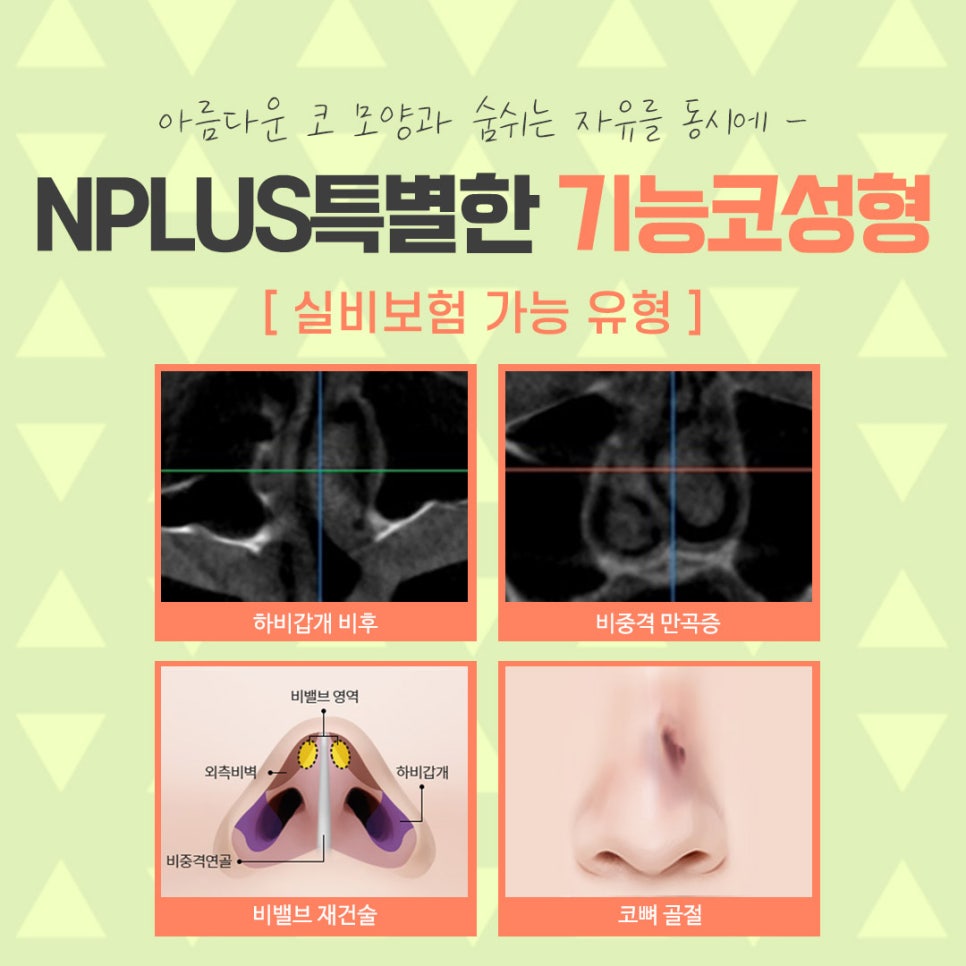 코성형보험에 대해 정확하게 알아보고 관련 이미지 12