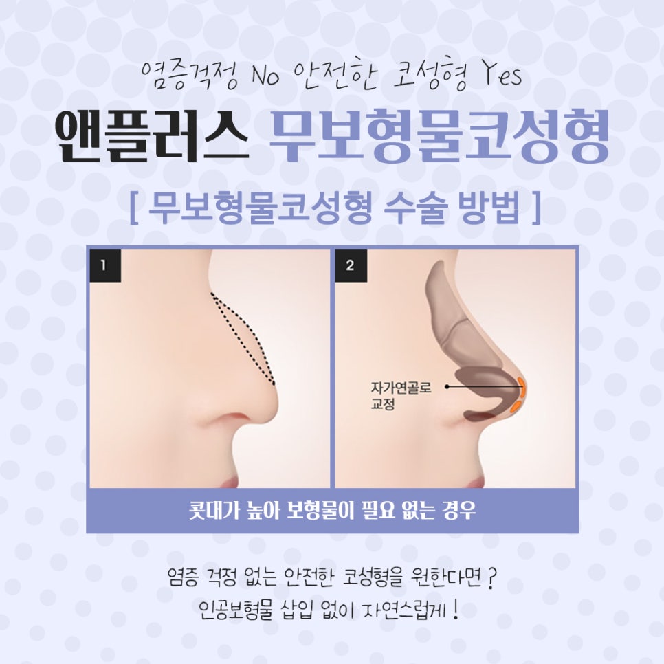 Review of Non-Implant Nose Surgery for a Beautiful Line image 9