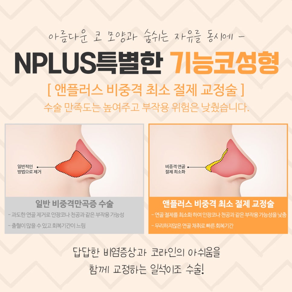 Making a Careful Decision After Researching an ENT Clinic for Rhinoplasty image 8