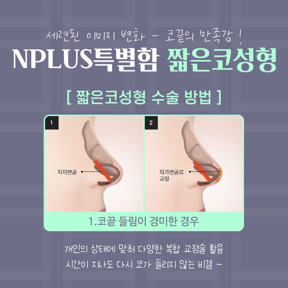 짧은코성형 후기를 보고 개선된 점 알아보기 관련 이미지 9