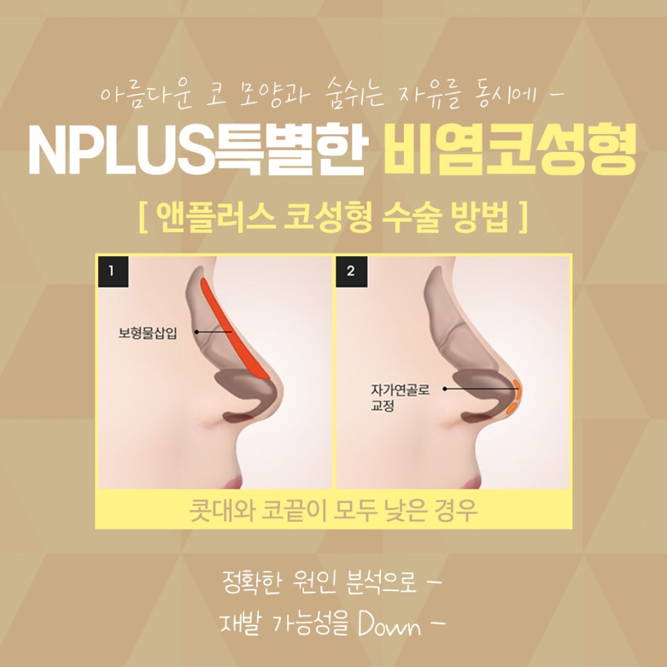 You Should Check the Rhinoplasty and Rhinitis Surgery Reviews Carefully Before Proceeding image 10