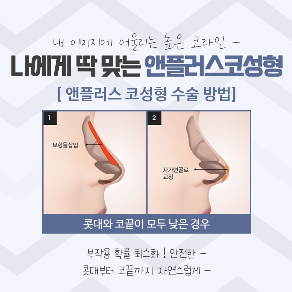 압구정코성형 자세하게 알아보고 관련 이미지 7