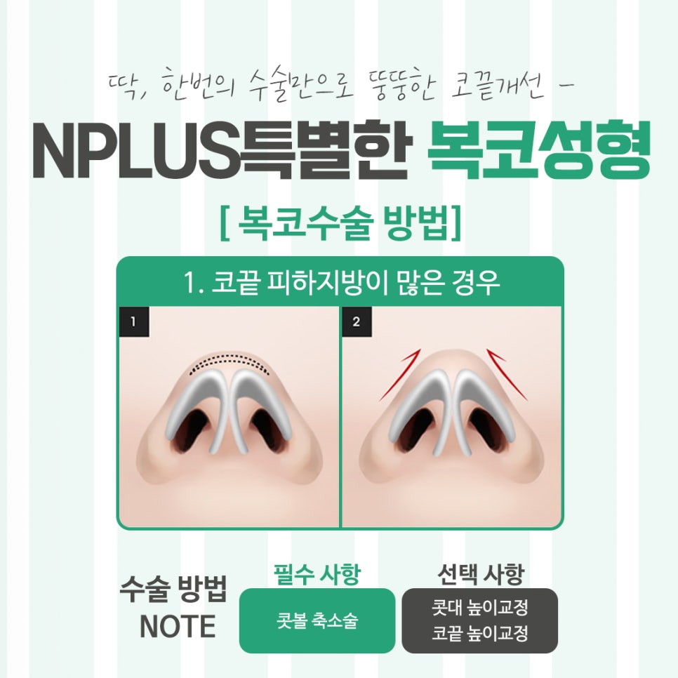 Looking Into Bulbous Nose Surgery Reviews to Improve Your Appearance image 7