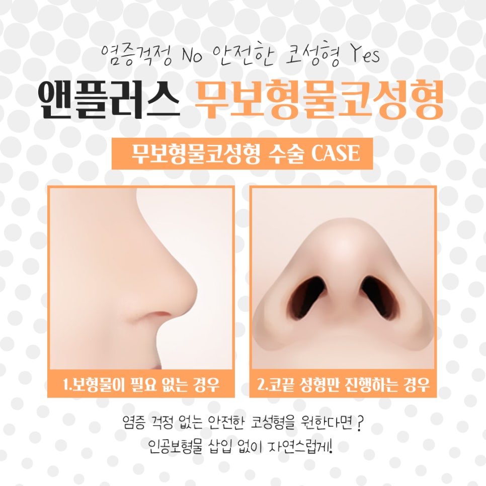 Sophisticated and Natural with Non-Implant Nose Surgery image 7