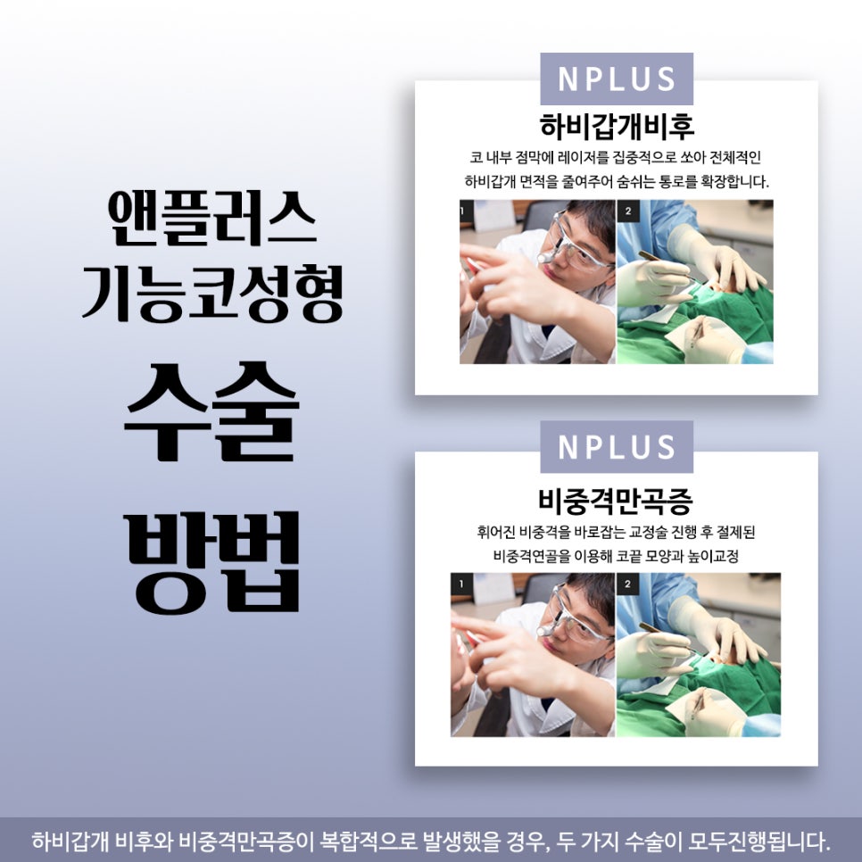 기능코성형비용에 대해 자세히 찾아보고 관련 이미지 10