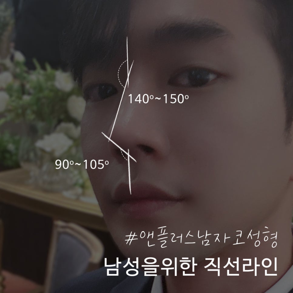 Male Nose Surgery Review, Including the Inside Examination image 6