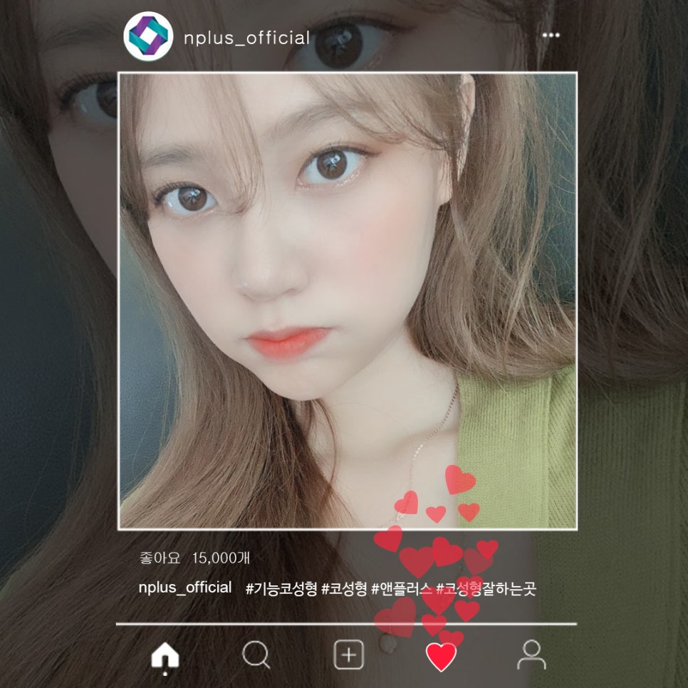 콧볼축소후기 확실하게 알아보고 관련 이미지 12